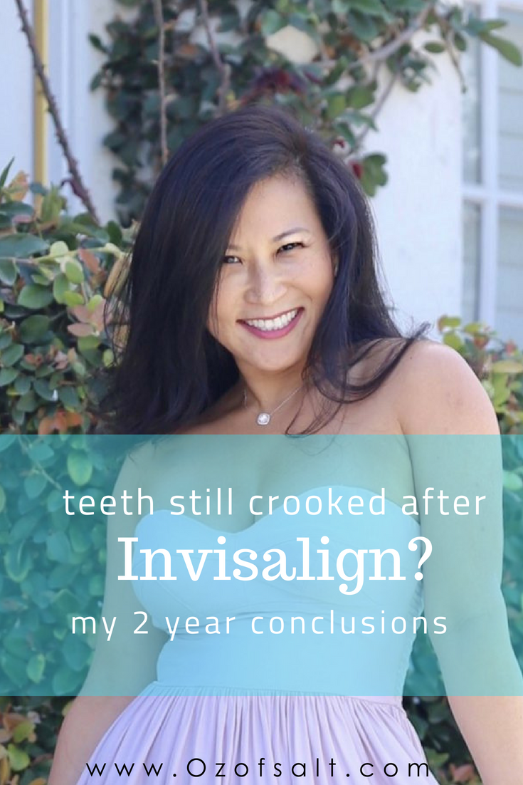 Invisalign Results: Are Your Teeth Crooked After Invisalign?